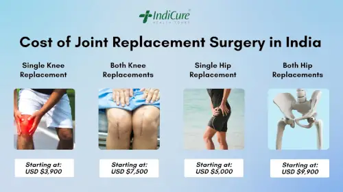 Cost of Joint Replacement Surgery in India